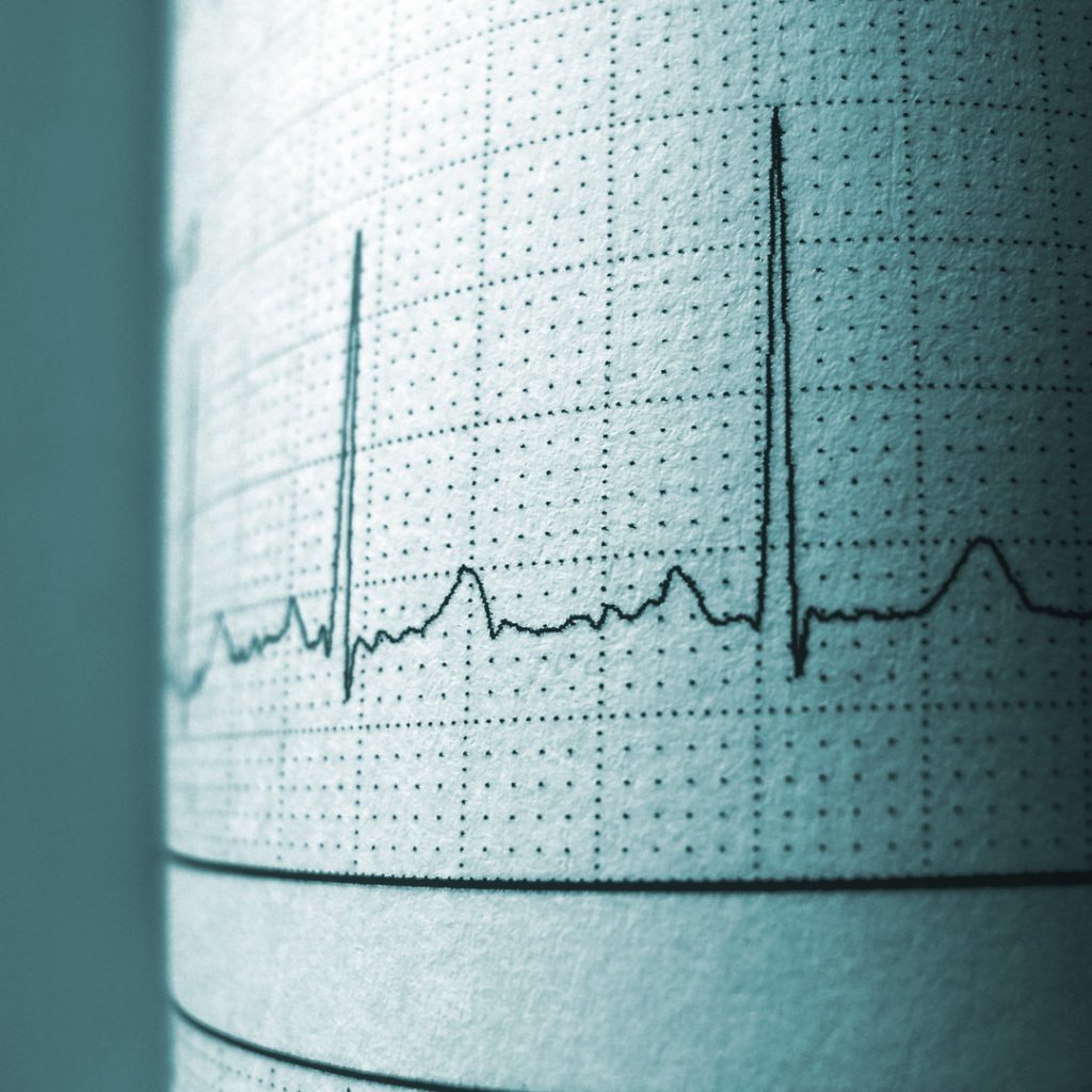 Diagnose Diagramm auf Papier